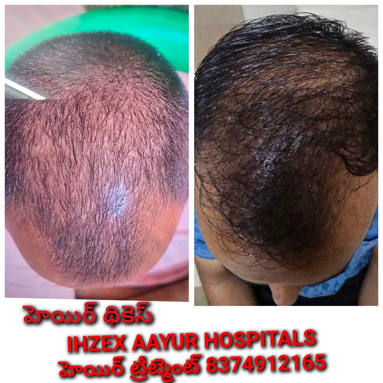 Patient Success Result 5