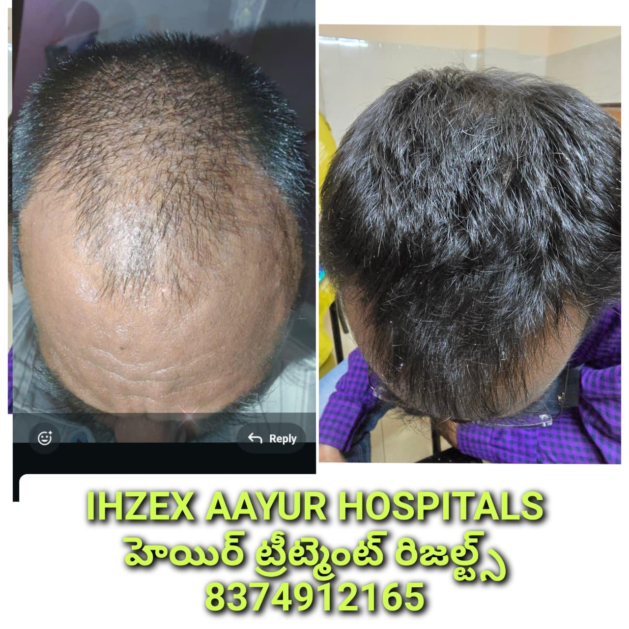 Patient Success Result 6
