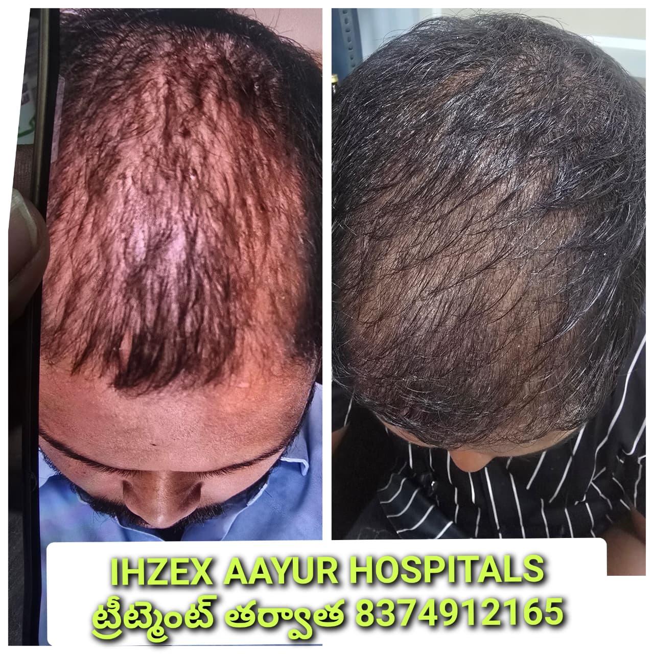 Patient Success Result 7