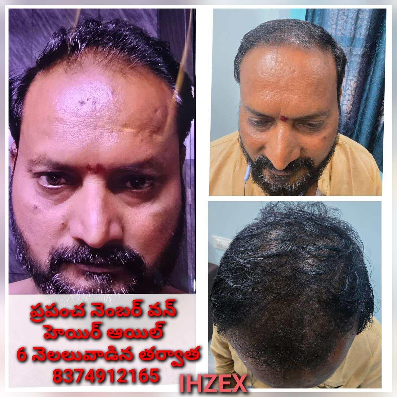 Patient Success Result 8