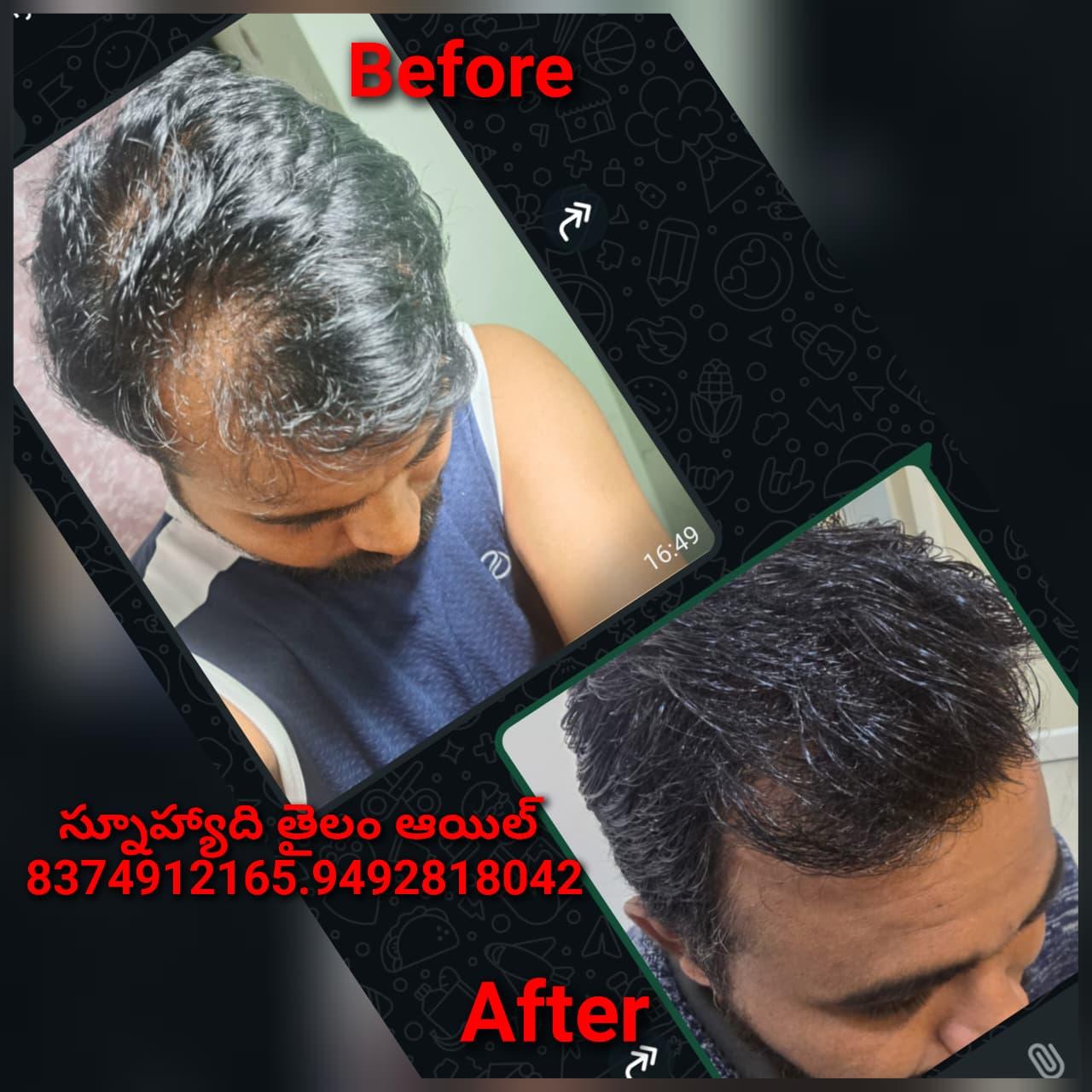 Patient Success Result 9