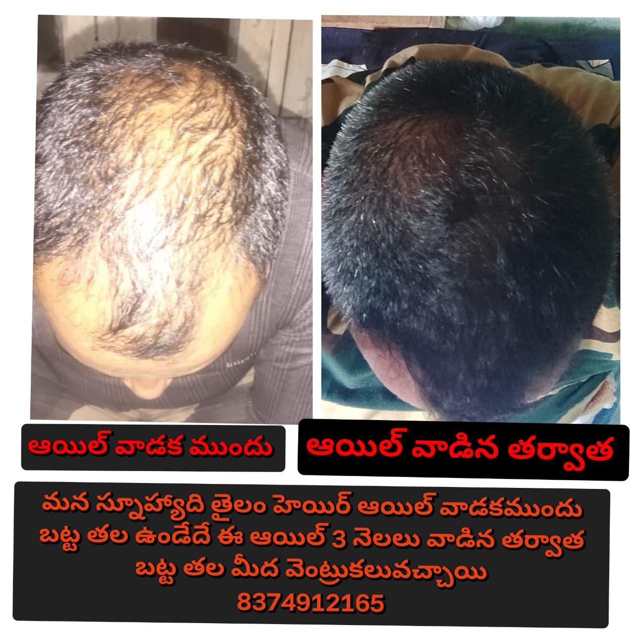 Patient Success Result 10