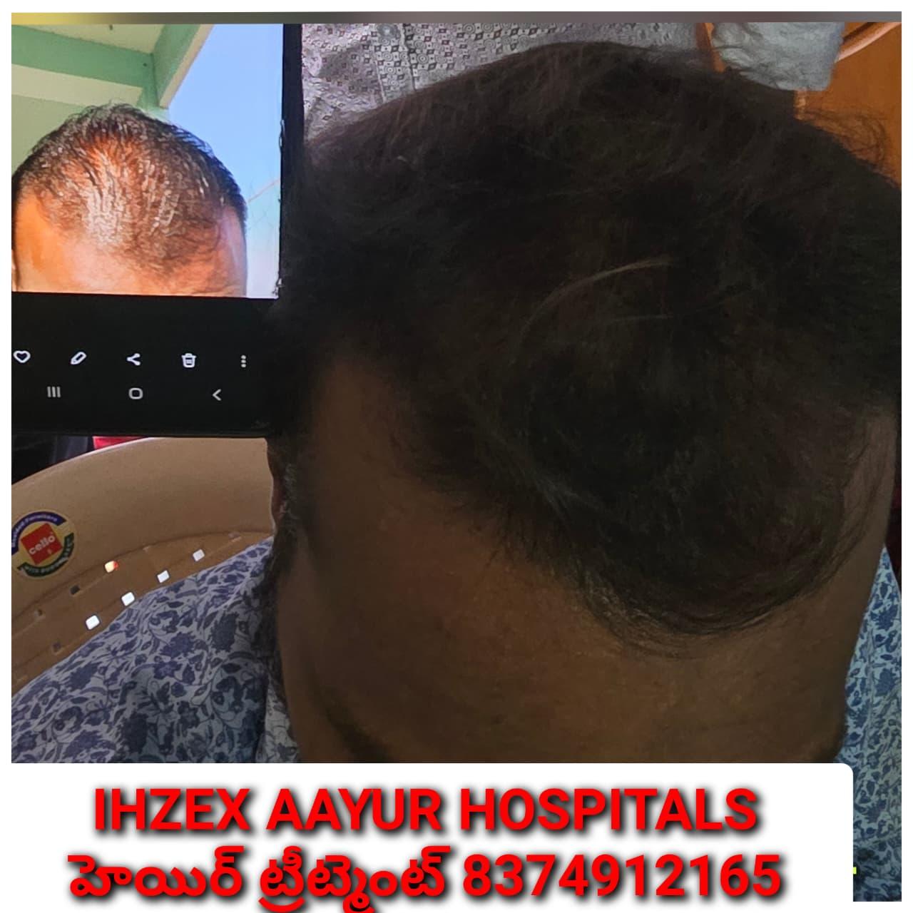 Patient Success Result 11