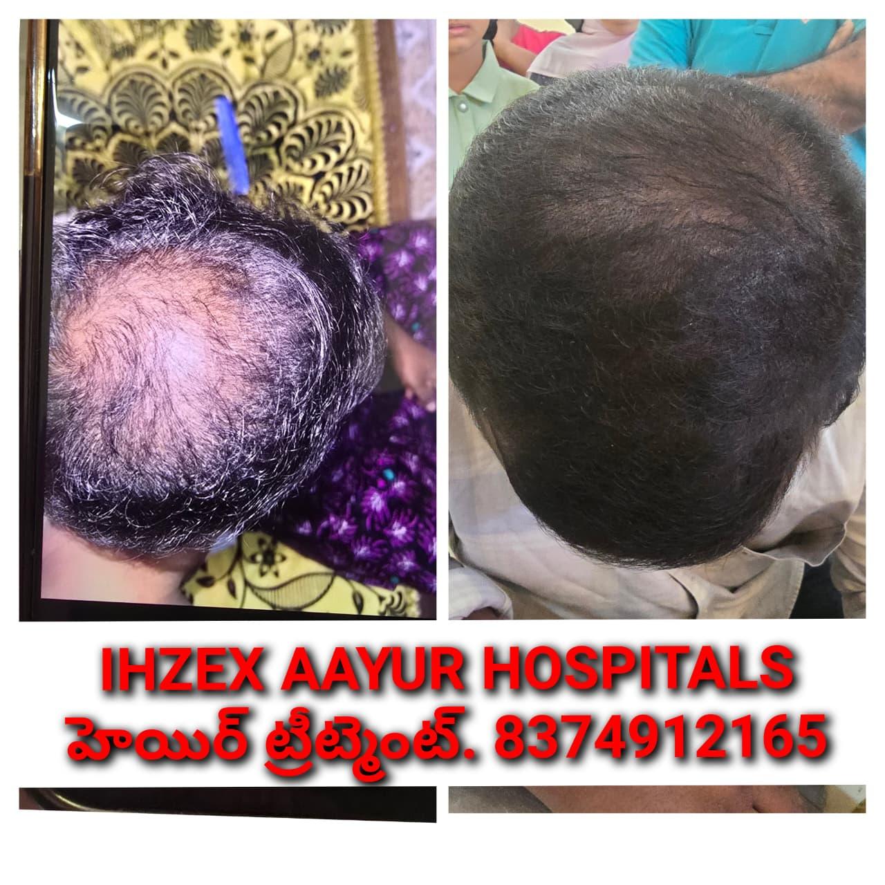 Patient Success Result 12