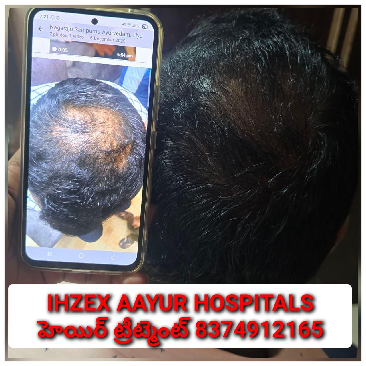 Patient Success Result 13