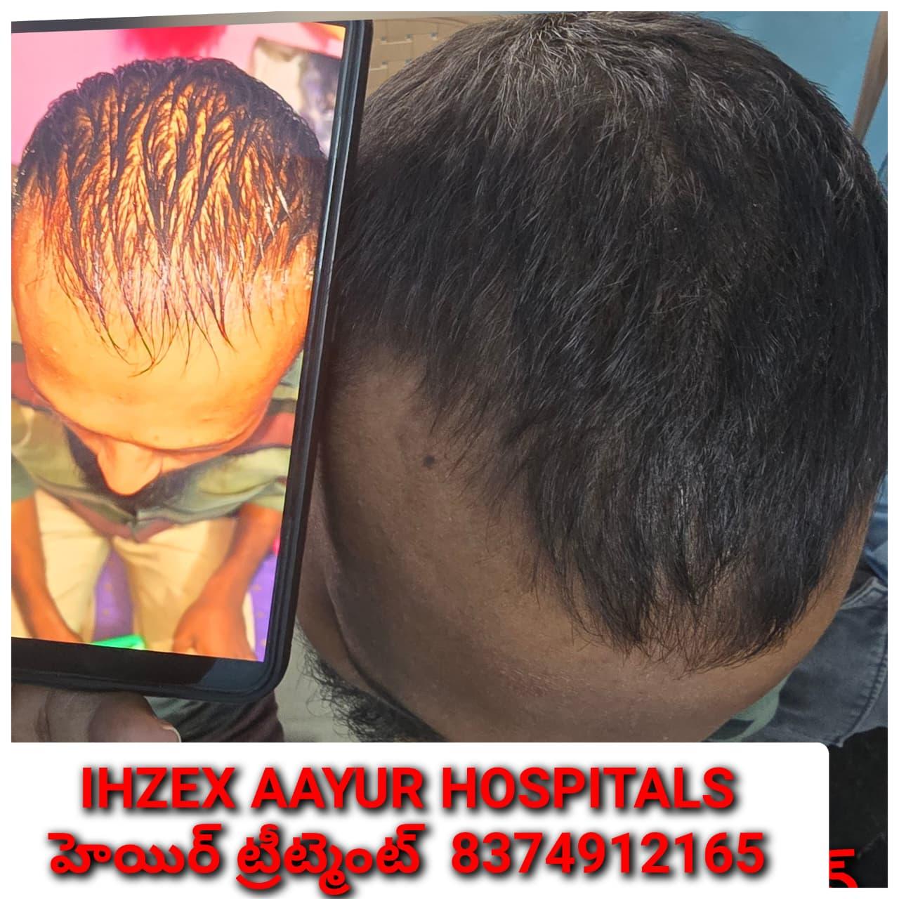 Patient Success Result 14