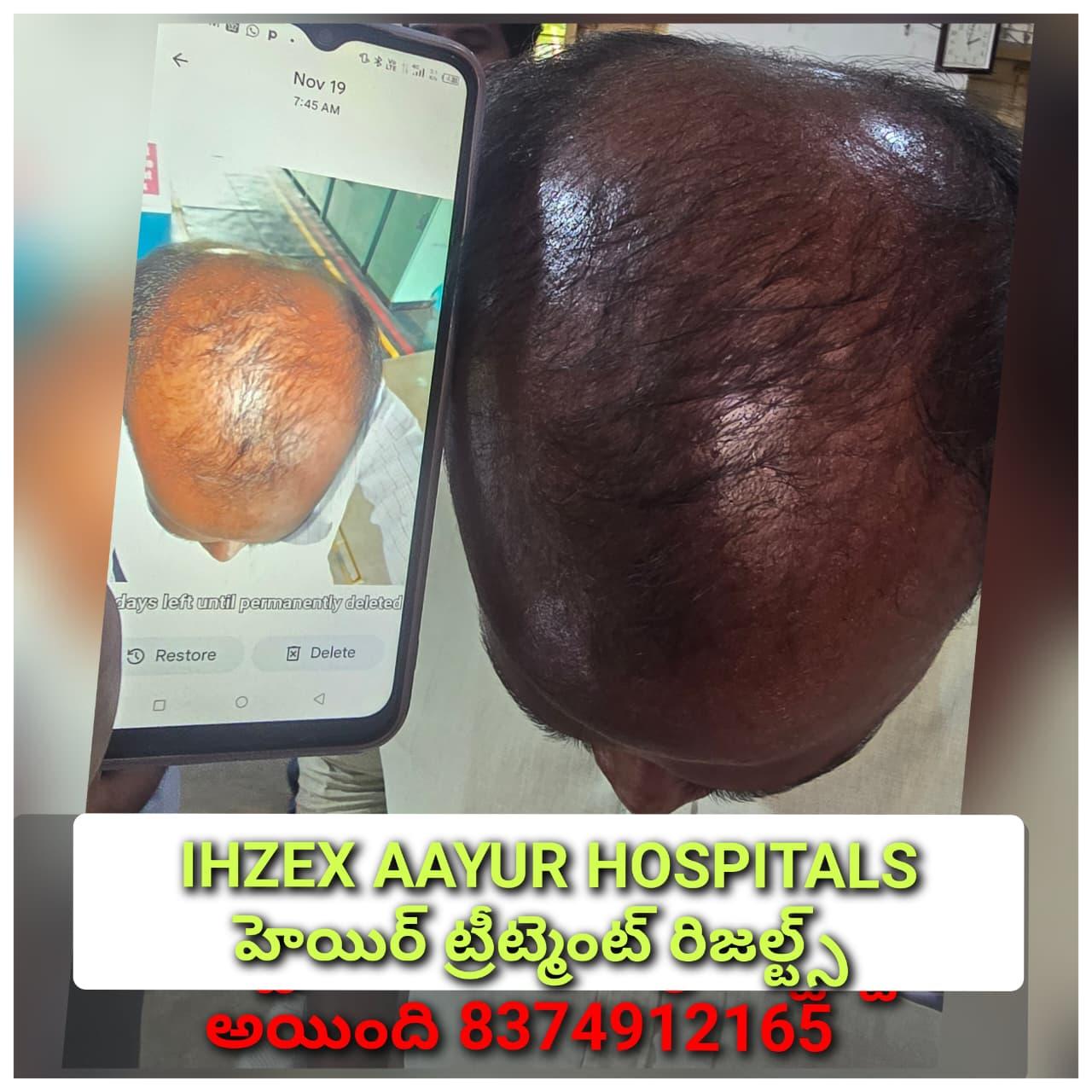 Patient Success Result 15