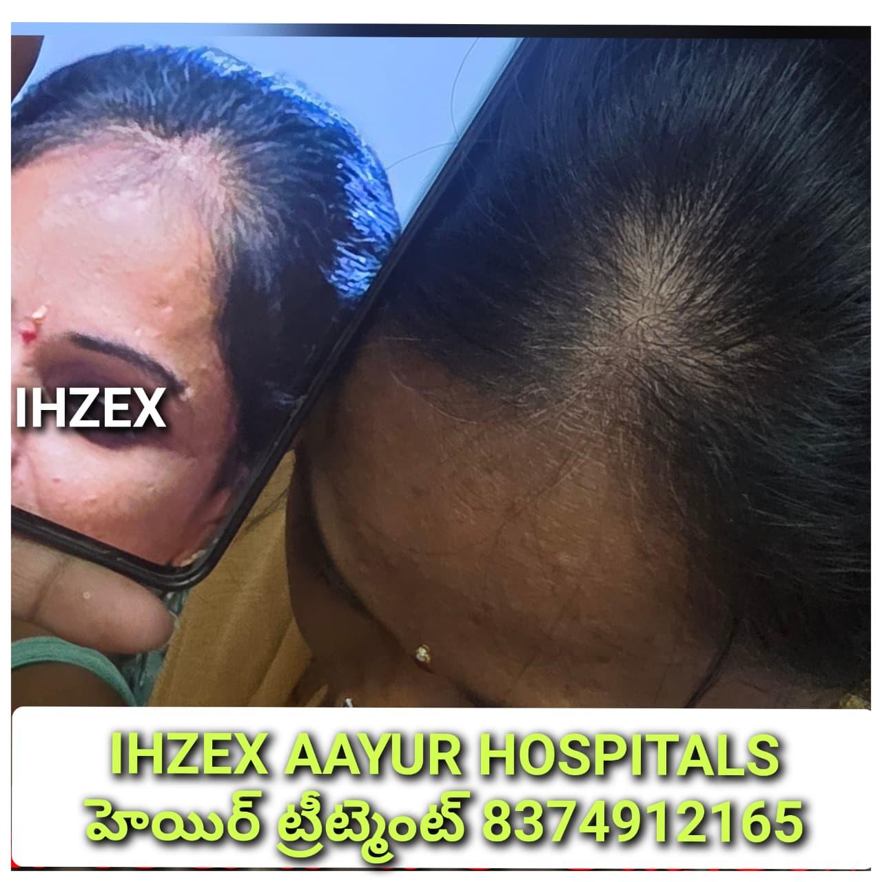 Patient Success Result 16