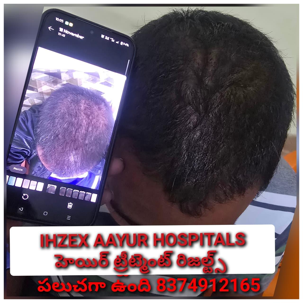 Patient Success Result 17
